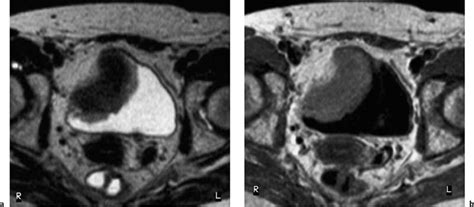 The Urinary Bladder Radiology Key