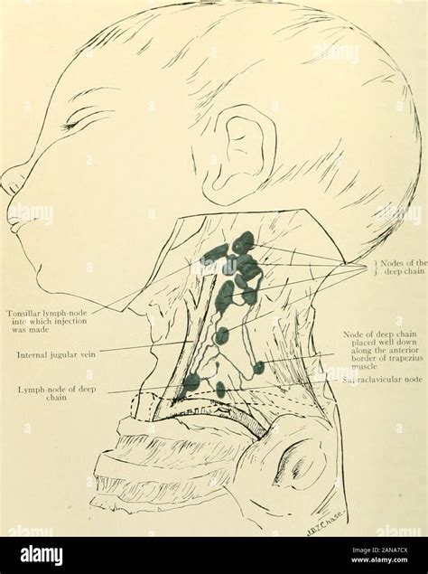 Supraclavicular Lymph Nodes