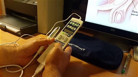 Лечение простатита аппаратом Смартпрост Smartprost - YouTube