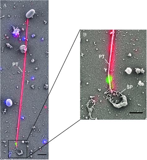 Correlative Light And Electron Microscopy Clem Analysis Of E Hellem