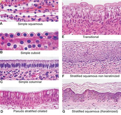 Stratified Squamous Epithelium Non Keratinized Labeled