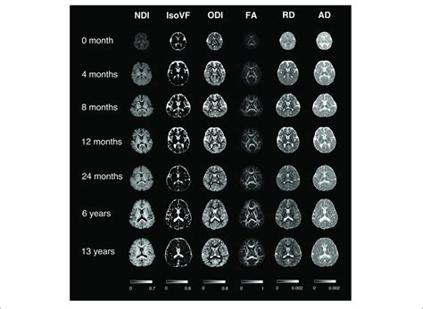 Representative Mappings Of Noddi And Dti Derived Metrics At Different