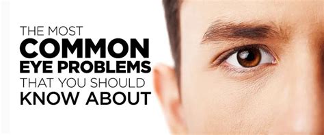 The Most Common Eye Problems That You Should Know About