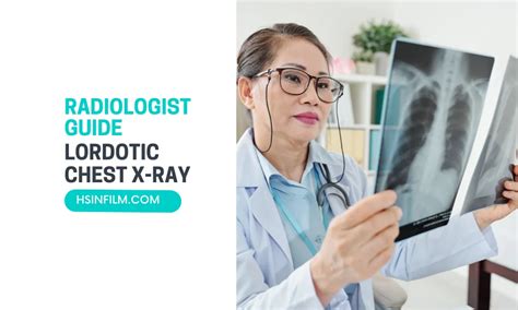 A Full Radiologist Guide on Lordotic Chest X-ray - HSIN FILM