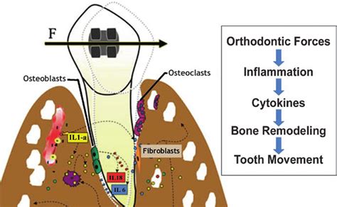 2 A Schematic Representing The Biological Events Of Orthodontic Tooth