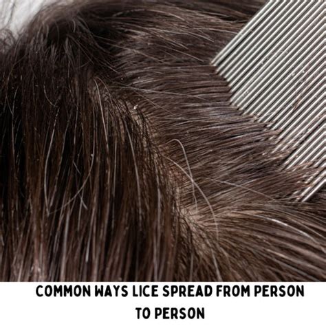 Best Anti-Lice Shampoos to Get Rid of Hair Lice Fast | Clinikally