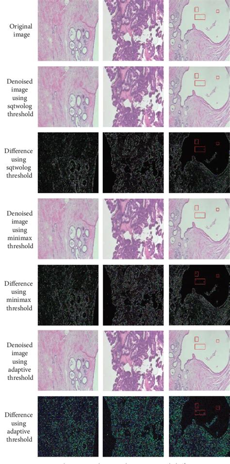 Figure From Adaptive Threshold Learning In Frequency Domain For