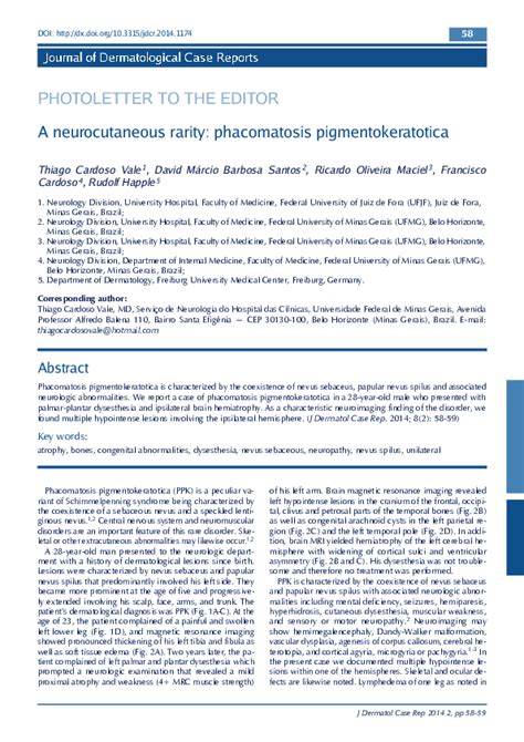 Pdf A Neurocutaneous Rarity Phacomatosis Pigmentokeratotica