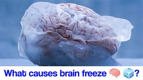 What Causes Brain Freeze YouTube