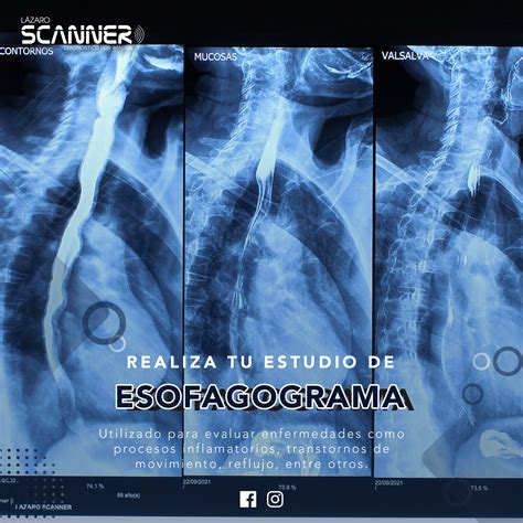 Radiografía Digital Lázaro Scanner Diagnóstico Por Imagen