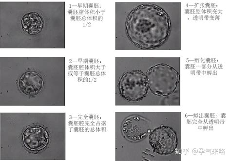 试管婴儿什么级别的胚胎，移植成功率更高？ 知乎