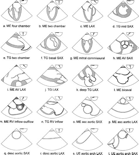 Figure 4 From ASE SCA Guidelines For Performing A Comprehensive