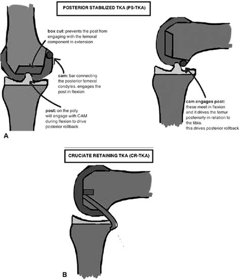 Figure 1 From No Difference In Recovery Of Patient Reported Outcome And