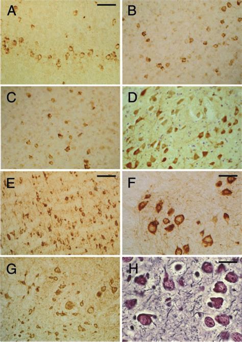 Tau Protein Immunoreactivity And Silver Staining In Brains And Spinal