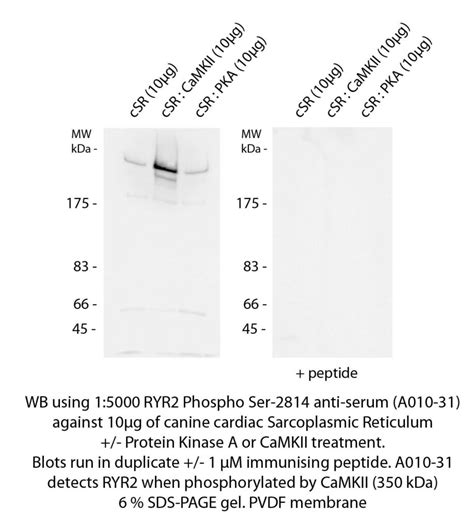 RYANODINE RECEPTOR 2 (RYR2) (pSER2814) pAB SERUM - Badrilla