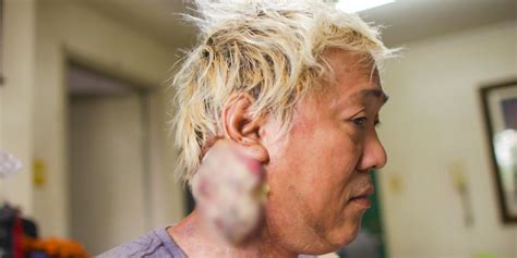 Ate Gay Diagnosed With Stage 4 Cancer Wala Raw Lunas GMA News Online