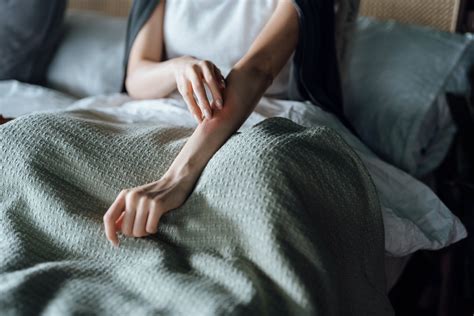 Rheumatoid Arthritis Rashes: Pictures, Causes, and Treatment
