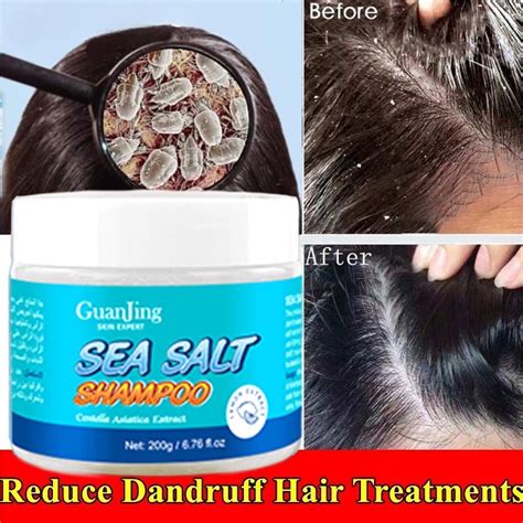 Yanjiayi Upgrade Sea Salt Shampoo Anti Dandruff Shampoo For Scalp