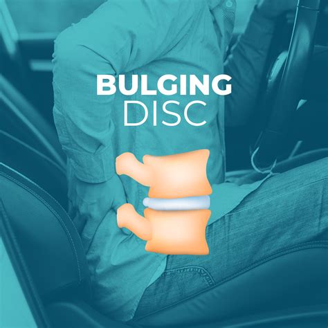 Bulging Disc vs. Herniated Disc - chiropractorvalparaiso.com