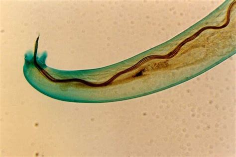 This eye worm, once only found in livestock, is cozying up to humans ...