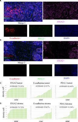 Frontiers High Expression Itga Affects The Expression Of Met Pd L