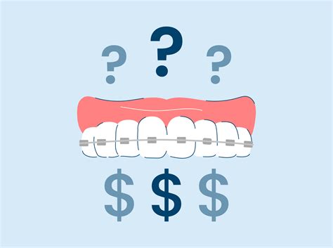 braces  expensive