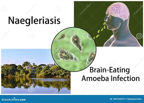 Naegleria Fowleri Krankheiten Und Behandlung Emedi