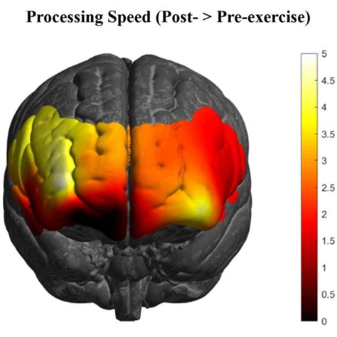 HbR Changes In The PFC As An Acute Effect Of Exercise N 92