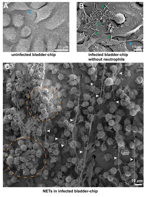 Figures And Data In Dynamic Persistence Of UPEC Intracellular Bacterial