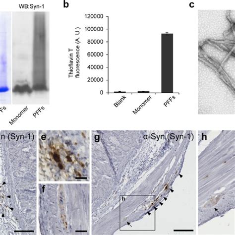 Inoculation Of α Synuclein α Syn Preformed Fibrils Pffs Into The