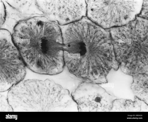 Anaphase Animal Cell Microscope - Interphase The Time Between Cell Divisions Ppt Video Online ...