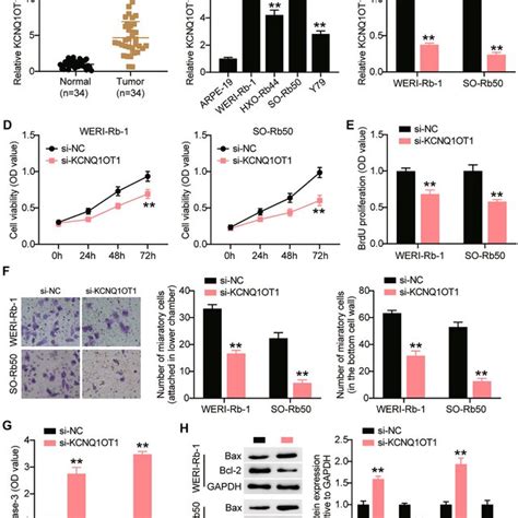 Silencing KCNQ1OT1 Inhibited The Malignant Proliferation Of RB Cells A