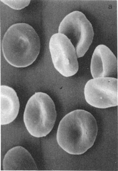 Sem Of Unloaded A And Fdump Loaded B Human Erythrocytes X