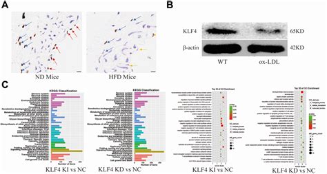 Klf4 Inhibited The Senescence Associated Secretory Phenotype In Ox Ldl