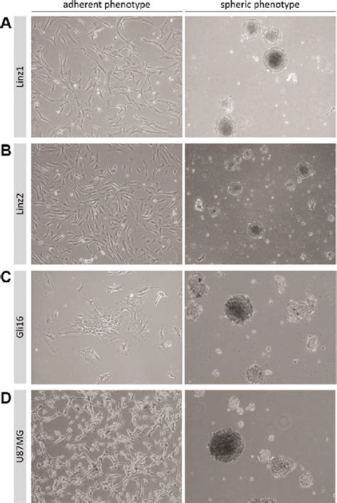 Spheroid Generation Of Glioblastoma Cells In Vitro Phase Contrast