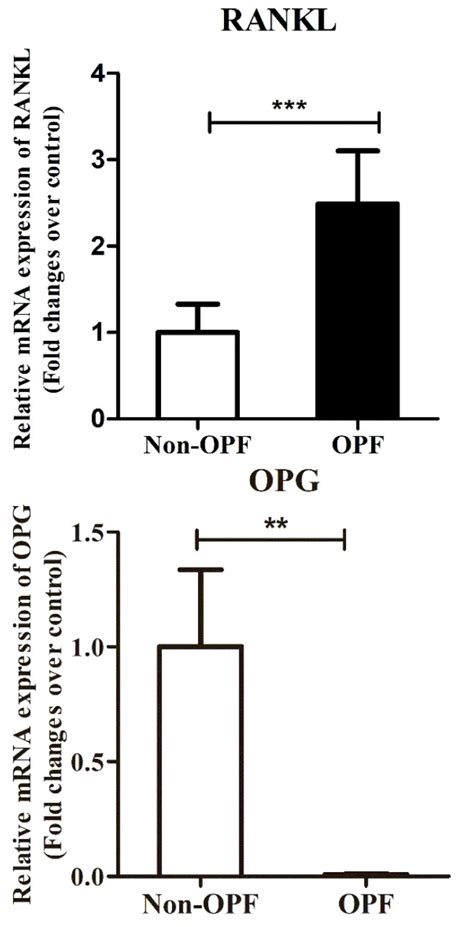 Influence Of DNA Methylation On The Expression Of OPG RANKL In Primary