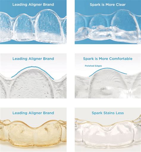 Spark Clear Aligners Wall Township Clear Braces Wall NJ