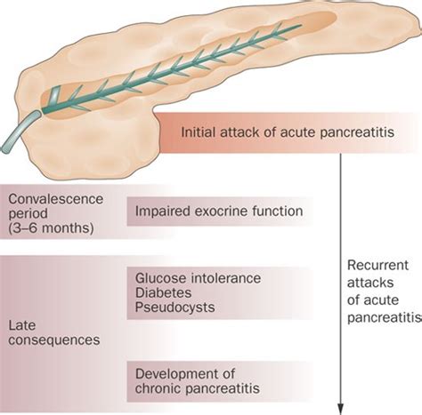 How Quickly Does Pancreatitis Develop