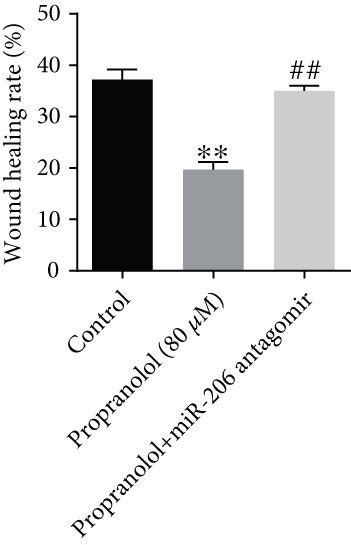 Downregulation Of Mir Reverses Propranolol Induced Inhibition Of