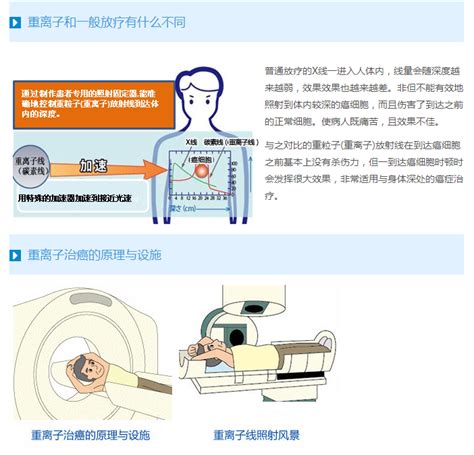 重离子治疗 日本医院及相关介绍 传祺国际健康