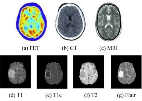 The Multi Modal Medical Images A C Are The Commonly Used