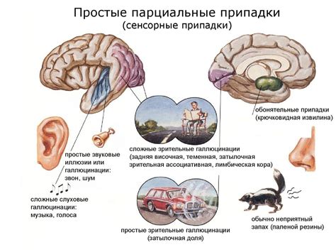 Пароксизмальные расстройства сознания - презентация онлайн