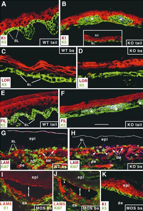 Figure From Conditional Ablation Of Beta Integrin In Skin Severe