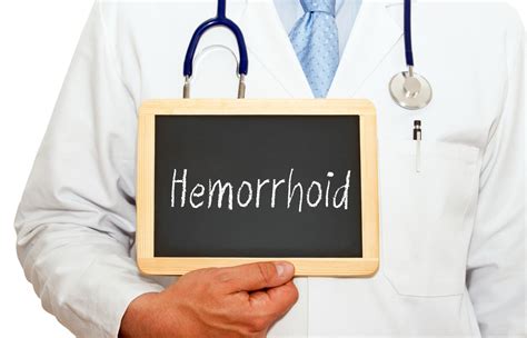 Types Of Hemorrhoids And How To Treat Them