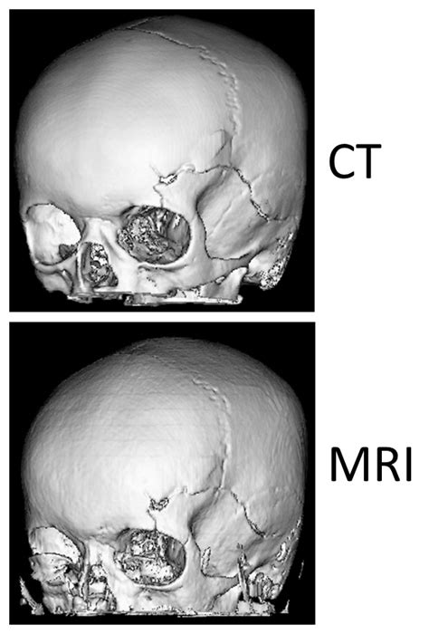 Magnetic Resonance Cranial Imaging In Pediatric Patients Evaluation Of