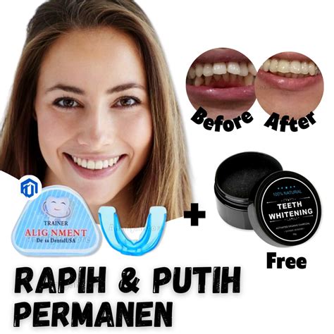 Jual Behel Lepas Pasang Alat Perapi Gigi Retainer Perapih Gigi Tanpa