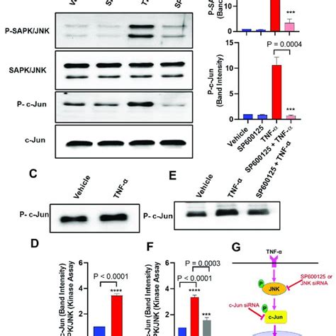 Tnf Induces Ip Expression In Mcf Cells Through The Jnk And