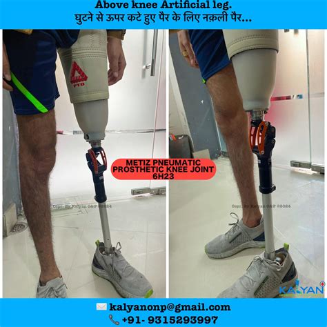 Kalyan Orthotics and Prosthetics - It is also called as degenerative