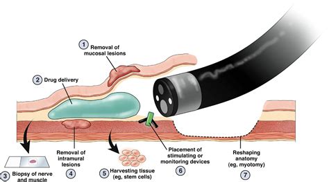 Endoscopy 20 Years Into The Future Clinical Gastroenterology And