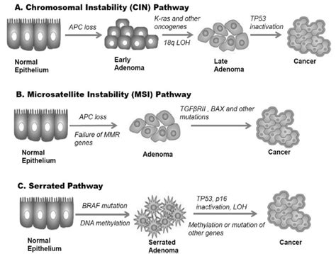 Multiple Genetic Pathways In Crc Carcinogenesis A Chromosomal